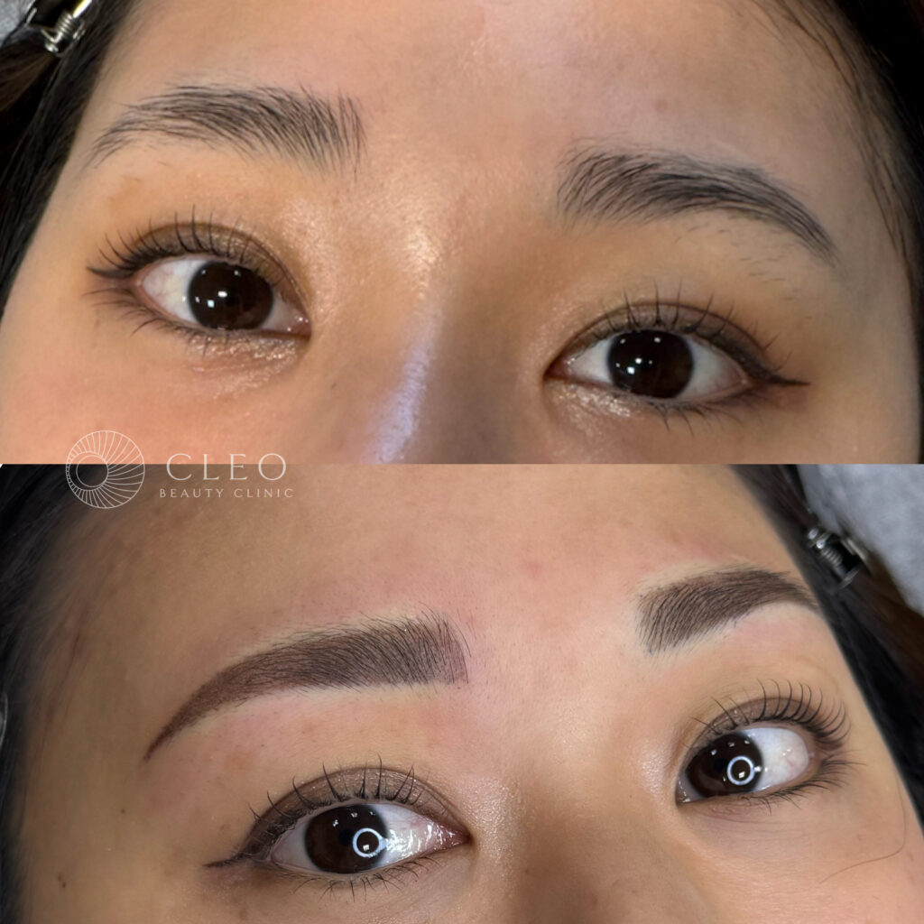20代女性 、左右差が気になる方の3Dアイブロウの症例
