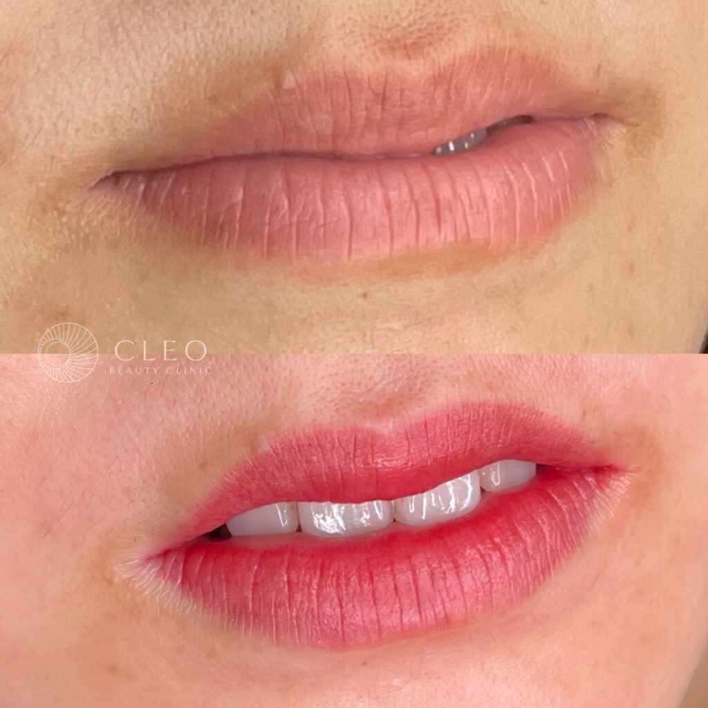 40代女性 ヴィヴィッドカラーで血色感アップ