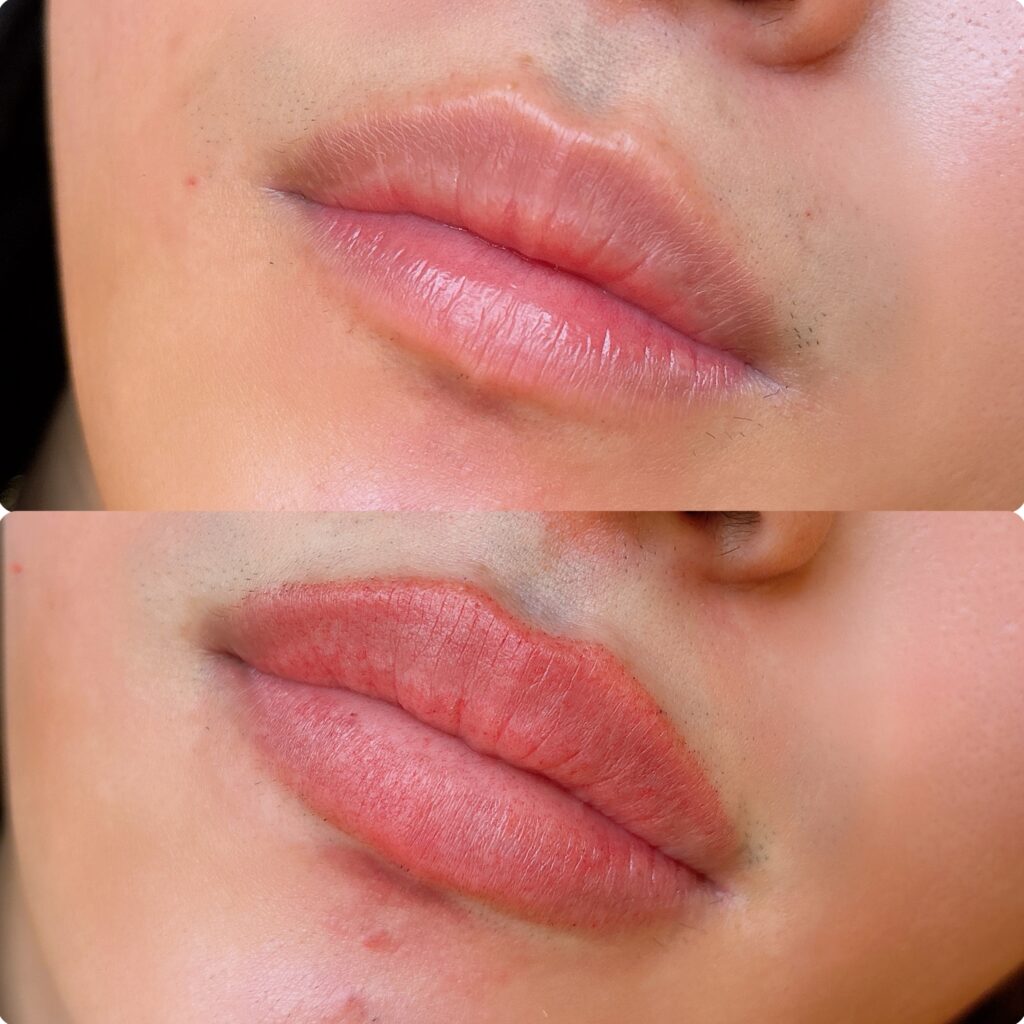 メンズのリップアートメイク症例
