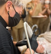 クレオビューティークリニックでのりねぇがポテンツァをしているところ