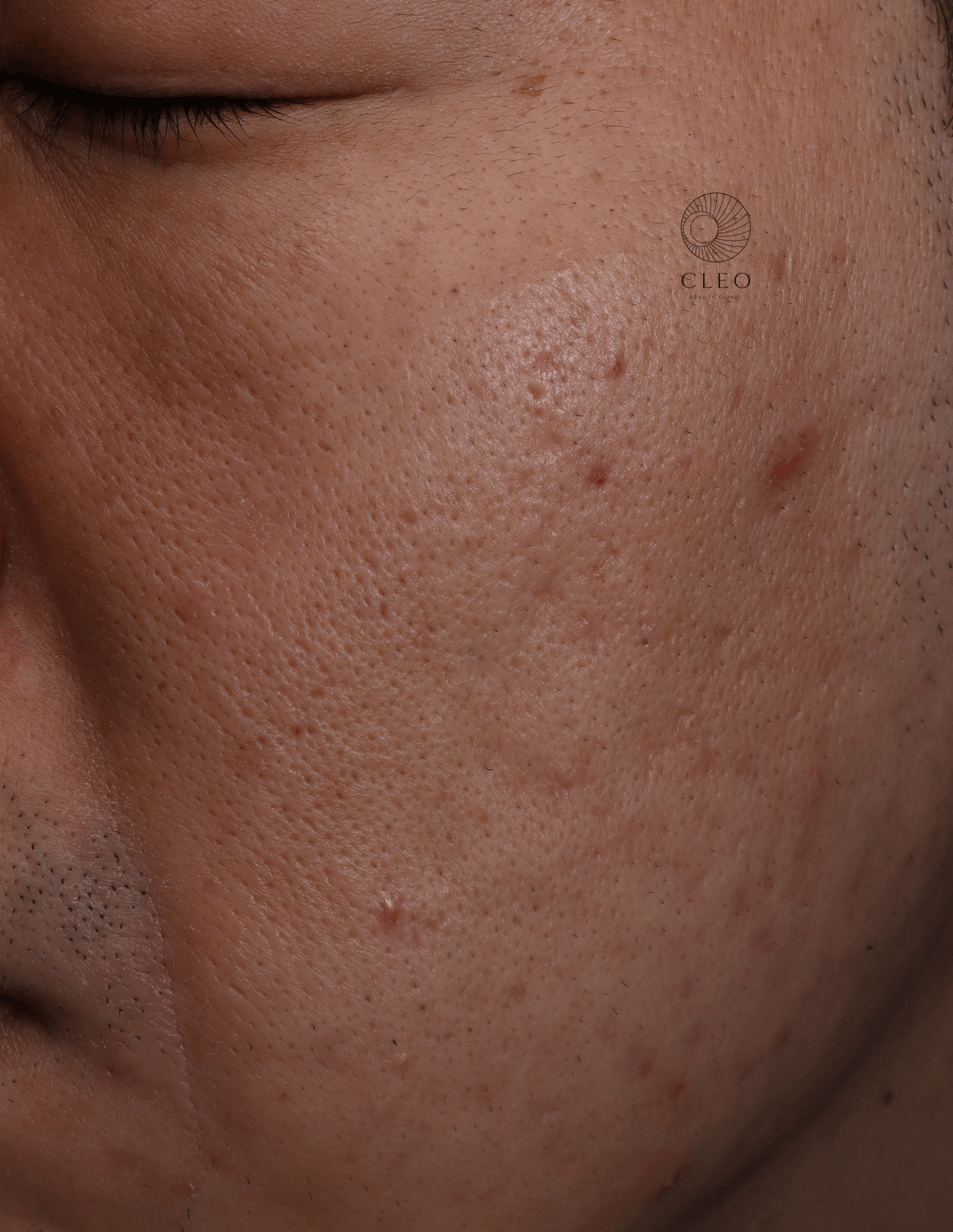 ポテンツァ症例アフター