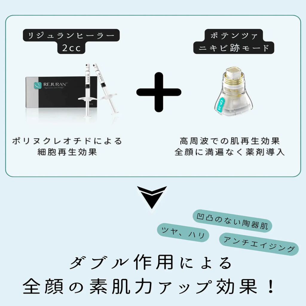 リジュランとポテンツァの組み合わせ治療