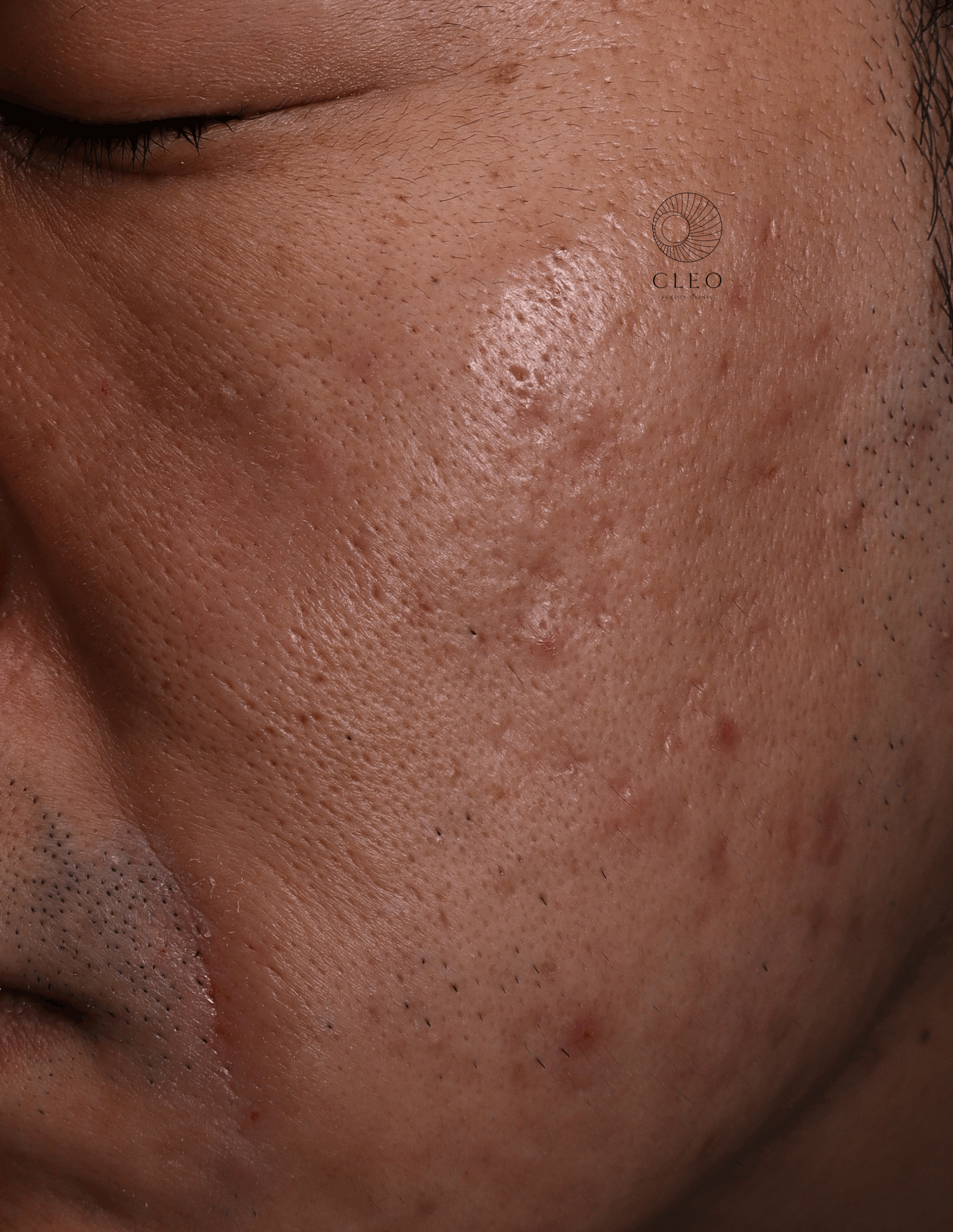 ポテンツァ症例ビフォー